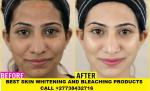 Permanent Skin Lightening Skin Whitening Products in Stockholm +27738432716 - Sell advertisement in Stockholm